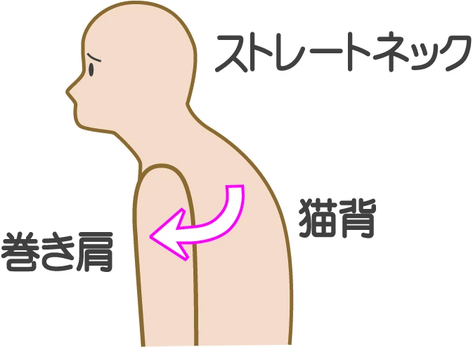 首の痛みを軽減し、心地よい毎日を手に入れよう！