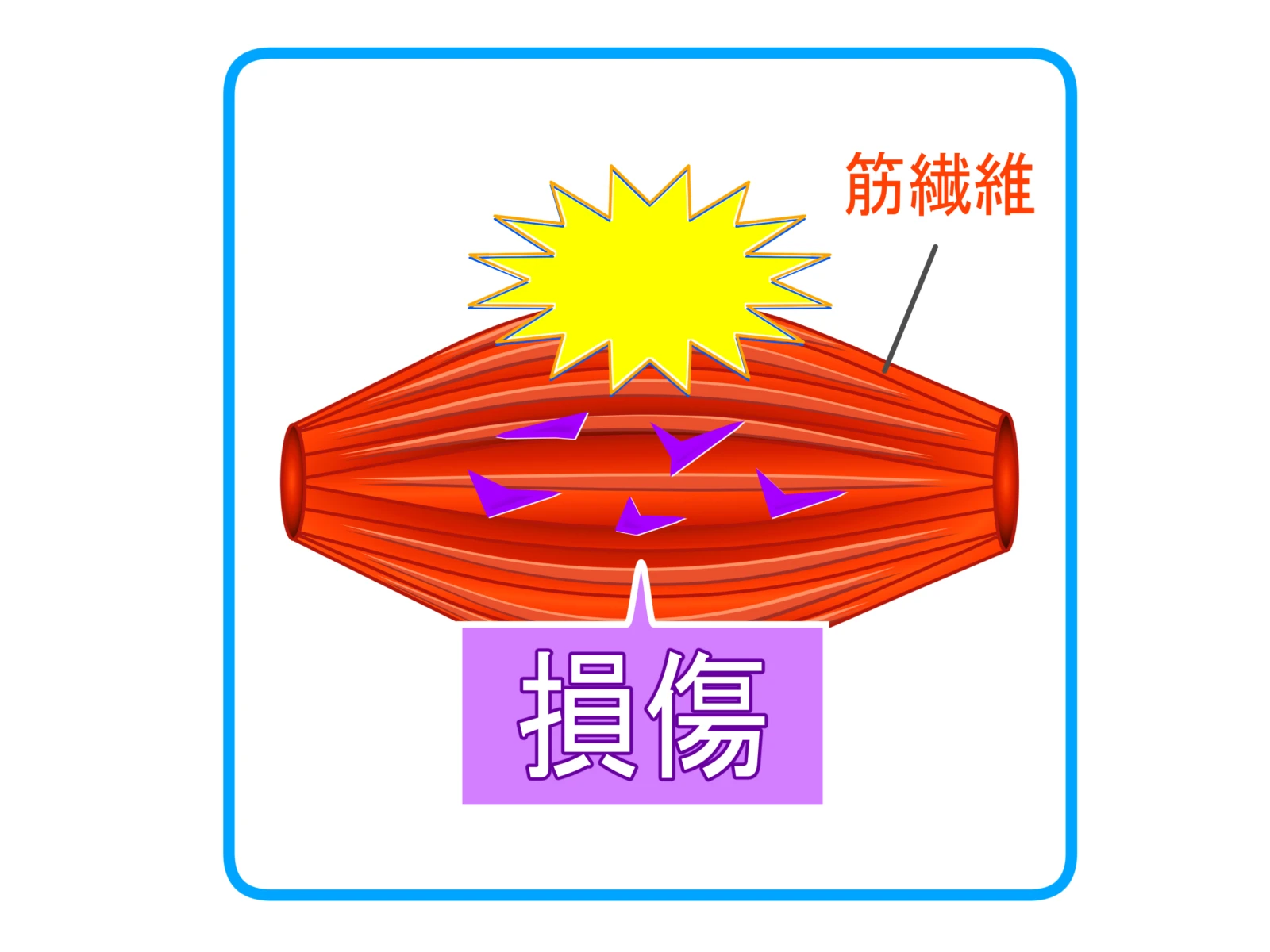 痛み緩和のメカニズム
