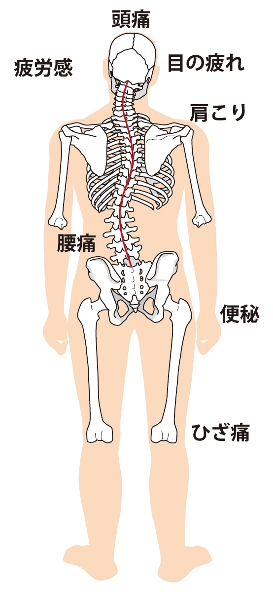 2. 歪みがもたらす辛い症状