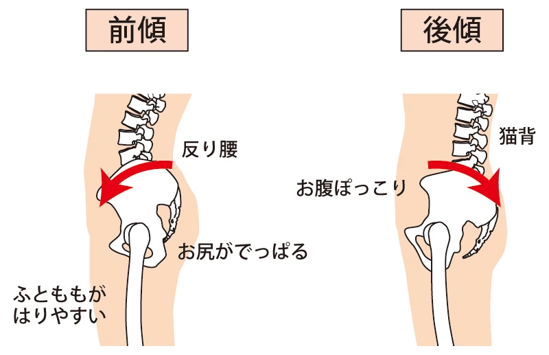 あなたの体、歪んでいませんか？