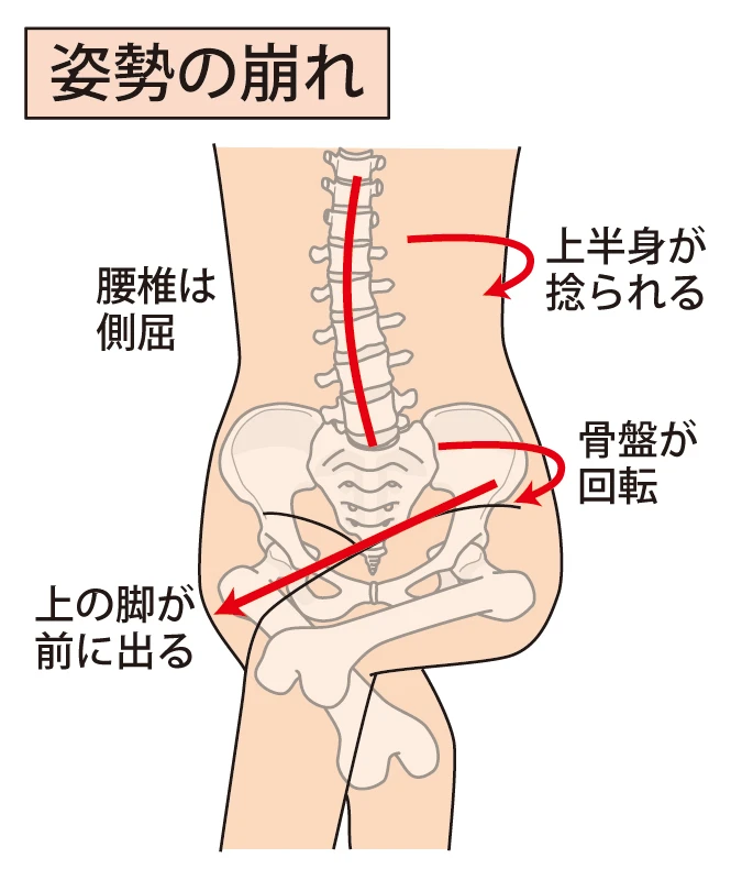 2. 背骨の歪みがもたらす影響