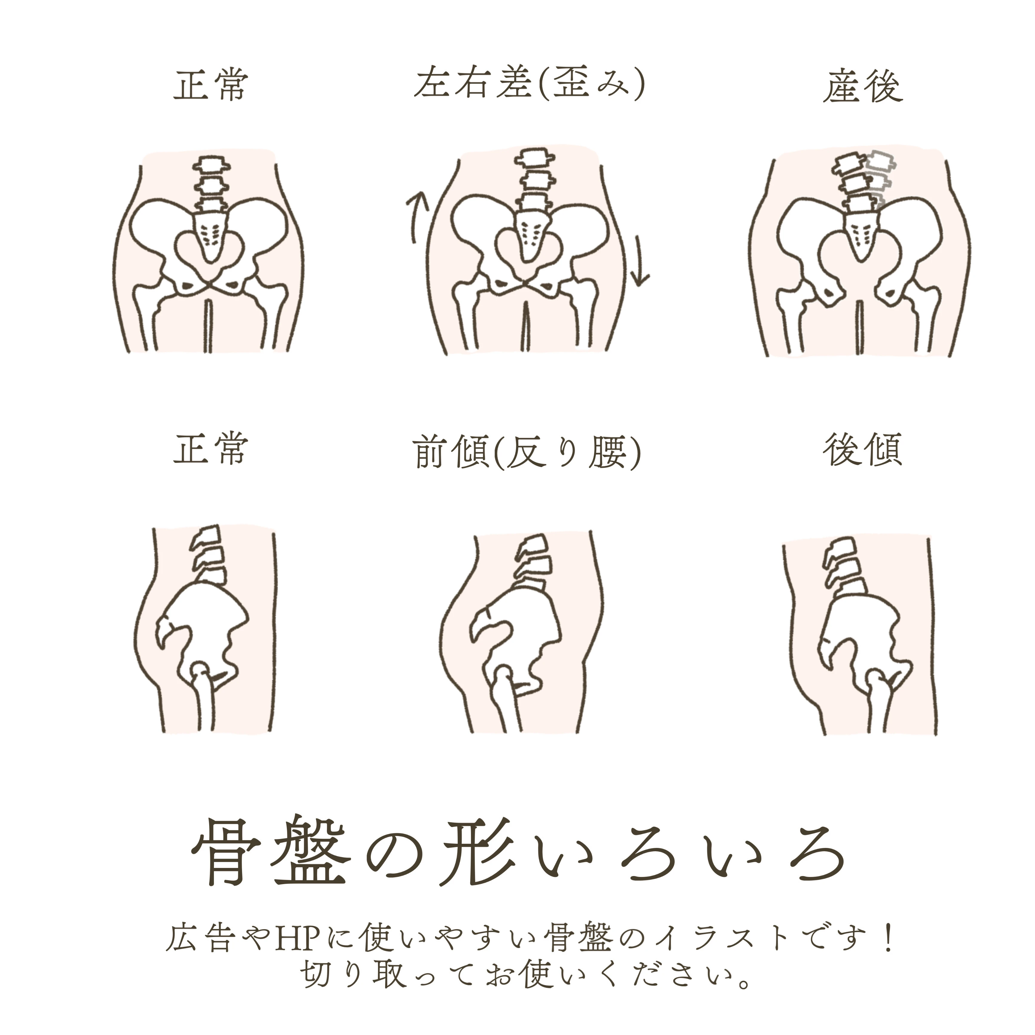 5. 骨盤矯正の解消できる症状