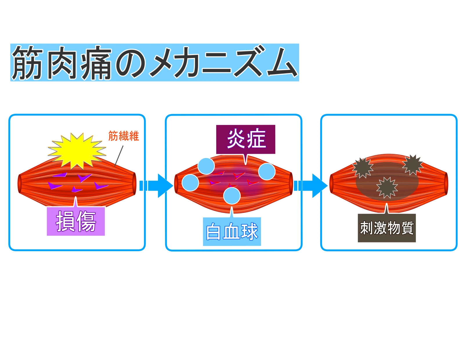痛みのメカニズムを理解する